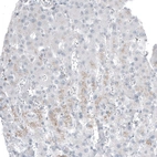 Immunohistochemical staining of human liver shows negative to no positivity in hepatocytes as expected.