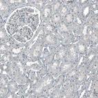 Immunohistochemical staining of human kidney shows no positivity in cells in tubules as expected.