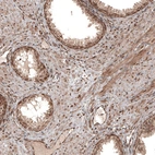 Immunohistochemical staining of human prostate shows strong nuclear positivity in smooth muscle cells.