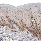 Immunohistochemical staining of human cervix, uterine shows moderate to strong nuclear positivity in squamous epithelial cells.