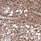 Anti-CDK4 Antibody