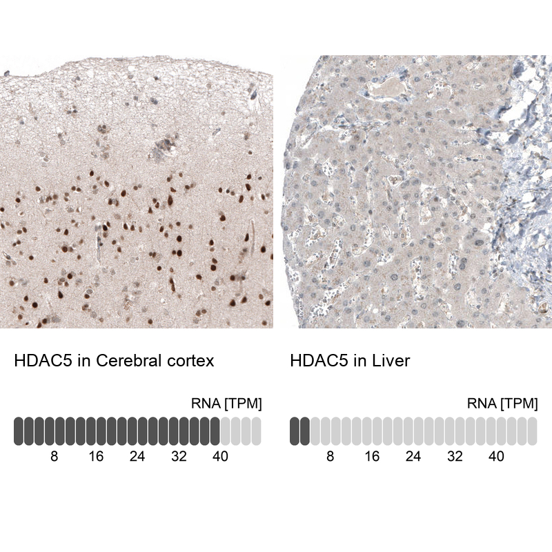 Anti-HDAC5 Antibody