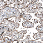 Anti-HDAC5 Antibody