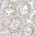 Immunohistochemical staining of human testis shows moderate to strong nuclear positivity in cells in seminiferous ducts.