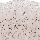 Immunohistochemical staining of human cerebral cortex shows strong nuclear positivity in neurons.