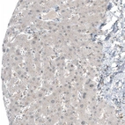 Immunohistochemical staining of human liver shows no positivity in hepatocytes as expected.
