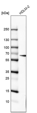 Anti-IL10RA Antibody