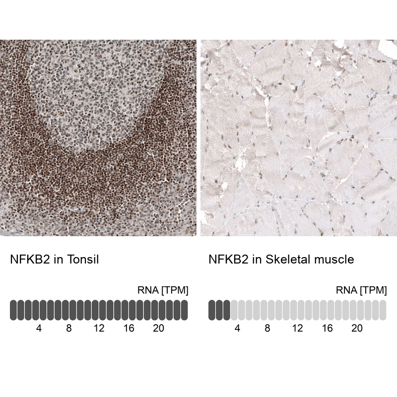 Anti-NFKB2 Antibody
