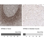 Anti-NFKB2 Antibody