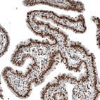 Immunohistochemical staining of human Fallopian tube shows strong nuclear positivity in glandular cells.