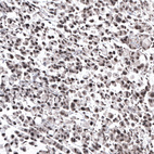 Anti-NFKB2 Antibody