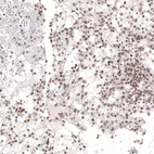 Anti-NFKB2 Antibody