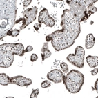 Immunohistochemical staining of human placenta shows moderate to strong nuclear positivity in trophoblastic cells.