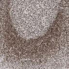 Immunohistochemical staining of human tonsil shows strong nuclear positivity in non-germinal center cells.