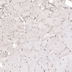 Immunohistochemical staining of human skeletal muscle shows very weak nuclear positivity in myocytes as expected.