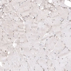 Immunohistochemical staining of human skeletal muscle shows very weak nuclear positivity in myocytes as expected.