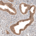 Immunohistochemical staining of human endometrium shows moderate cytoplasmic positivity in glandular cells.
