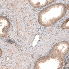 Immunohistochemical staining of human prostate shows moderate cytoplasmic positivity in glandular cells.