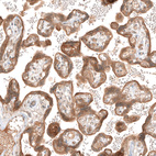 Anti-PIK3CA Antibody