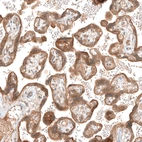 Immunohistochemical staining of human placenta shows moderate cytoplasmic positivity in trophoblastic cells.