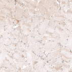 Immunohistochemical staining of human skeletal muscle shows very weak positivity in myocytes as expected.