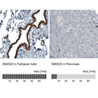 Anti-SMAD2 Antibody