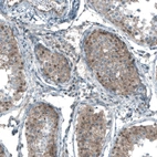 Immunohistochemical staining of human testis shows weak to moderate cytoplasmic and nuclear positivity in cells in seminiferous ducts.