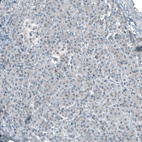 Immunohistochemical staining of human pancreas shows low cytoplasmic positivity in exocrine glandular cells as expected.
