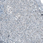Immunohistochemical staining of human pancreas shows low cytoplasmic positivity in exocrine glandular cells as expected.