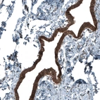 Immunohistochemical staining of human Fallopian tube shows strong cytoplasmic and nuclear positivity in glandular cells.