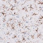 Immunohistochemical staining of human cerebral cortex shows strong membranous positivity in microglia.