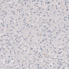 Immunohistochemical staining of human liver shows no positivity in hepatocytes as expected.