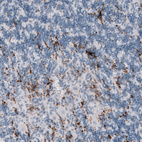 Immunohistochemical staining of human cerebellum shows strong membranous positivity in microglia.