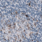 Immunohistochemical staining of human cerebellum shows strong membranous positivity in microglia.