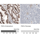 Anti-PGR Antibody