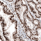 Anti-PGR Antibody