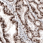 Immunohistochemical staining of human endometrium shows strong nuclear positivity in glandular cells.