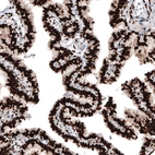 Immunohistochemical staining of human Fallopian tube shows strong nuclear positivity in glandular cells.