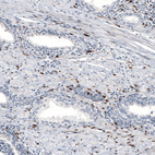 Immunohistochemical staining of human prostate shows moderate to strong nuclear positivity in smooth muscle cells.