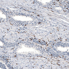 Anti-PGR Antibody