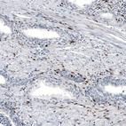 Immunohistochemical staining of human prostate shows moderate to strong nuclear positivity in smooth muscle cells.