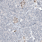 Immunohistochemical staining of human pancreas shows moderate to strong nuclear positivity in Langerhans cells.
