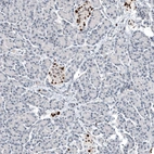 Immunohistochemical staining of human pancreas shows moderate to strong nuclear positivity in Langerhans cells.