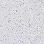 Anti-PGR Antibody