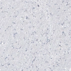 Immunohistochemical staining of human cerebral cortex shows no positivity in neurons as expected.