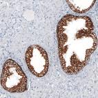 Immunohistochemical staining of human prostate shows strong cytoplasmic positivity in glandular cells.