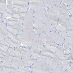 Immunohistochemical staining of human skeletal muscle shows no cytoplasmic positivity in myocytes as expected.
