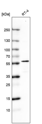 Western blot analysis in human cell line RT-4.
