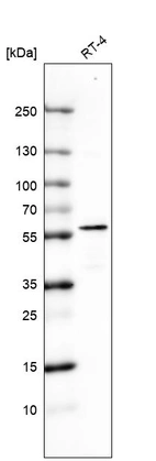 Western blot analysis in human cell line RT-4.
