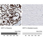 Anti-KRT7 Antibody